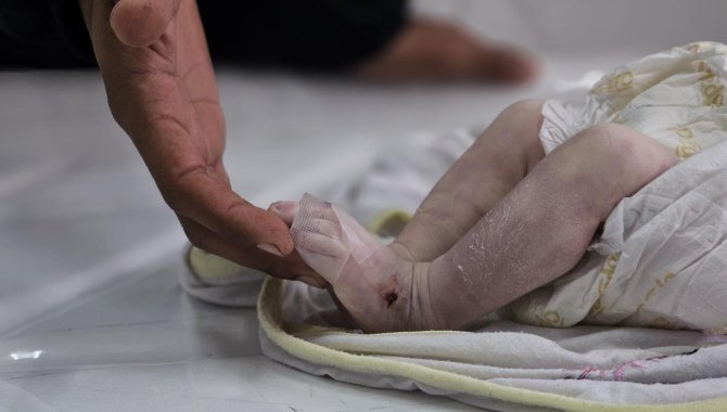 İsrail'in açlığa mahkum ettiği Gazze'de bir bebek daha açlıktan hayatını kaybetti