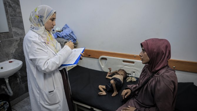 Gazze Şeridi'nde "açlığın" sembolü haline gelen Filistinli bebeğin doktoru İsrail'in iddialarını yalanladı