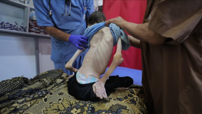 İsrail'in kıtlığı dayattığı Gazze Şeridi'nde son 24 saatte 2'si çocuk 3 kişi daha açlıktan hayatını kaybetti