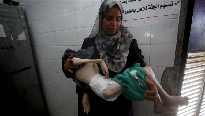 Filistinli 13 yaşındaki Tamir Şuhaybir Gazze'de annesinin kollarında açlıktan öldü