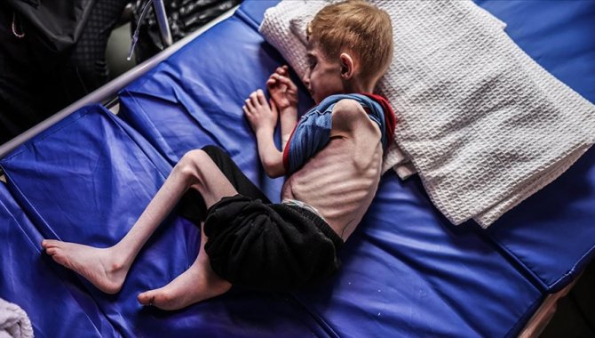 DSÖ: "Tıbbi tahliyeler, Gazze'den gelen hasta ve yaralı çocuklara bir yaşam şansı veriyor"