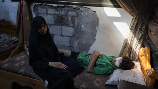 İsrail'in kitlesel açlığa maruz bıraktığı Gazze'de yardım almaya giden 15 yaşındaki Taha gözlerinden oldu