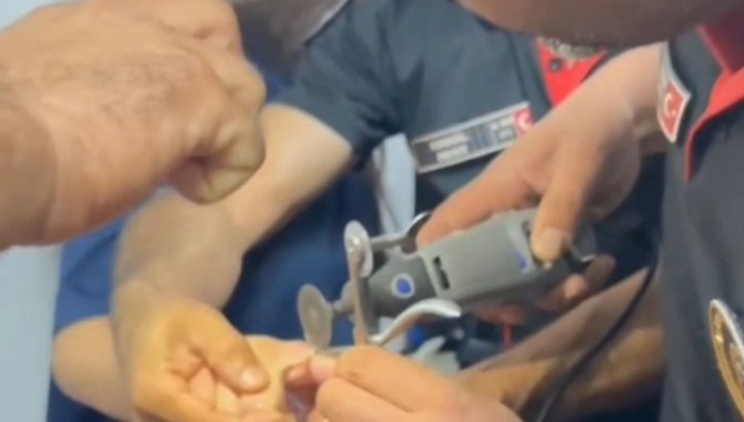 Kahramanmaraş'ta genç kızın parmağında sıkışan yüzük itfaiye ekibince hastanede çıkarıldı