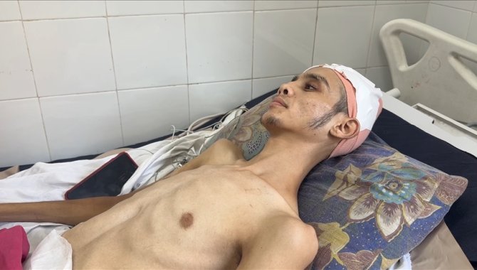 Gazze'de yardım almaya giderken başından vurulan Filistin halk oyunları dansçısı Ahmed'in hayatı karardı