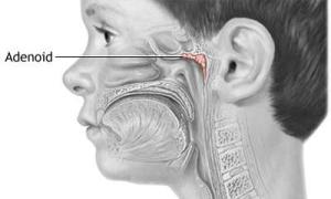 Çocuklarda “adenoid yüz”e dikkat!