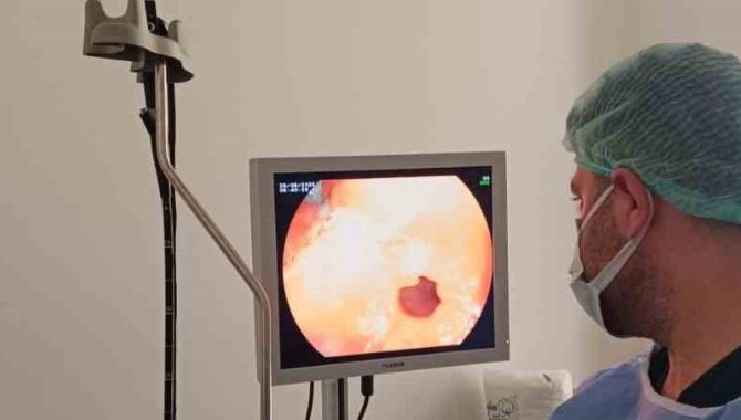 Çermik Devlet Hastanesinde endoskopi ve kolonoskopi ünitesi hizmete girdi