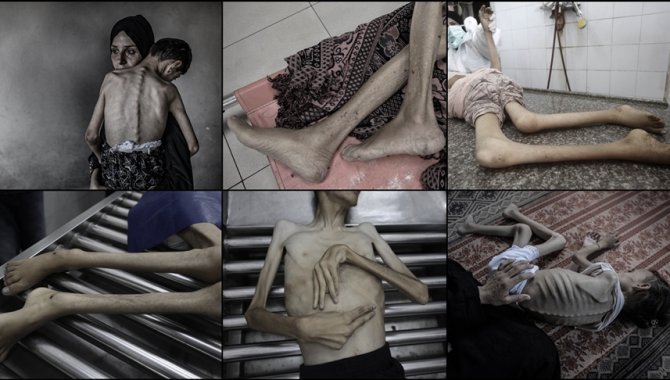 İsrail'in kıtlığı dayattığı Gazze'de ağustos ayında 185 kişi açlıktan yaşamını yitirdi