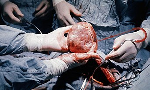 Organ nakli merkezi ayarı
