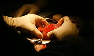 Açık kalp ameliyatında yeni yöntem