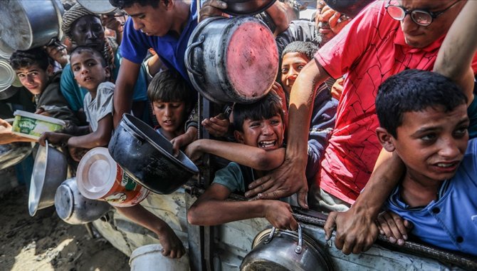 İsrail'in uyguladığı abluka ve sistematik açlık politikasının küçük kurbanı Ali yaşam mücadelesi veriyor