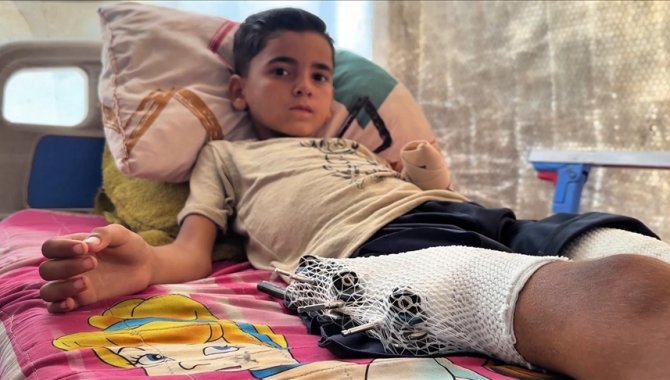 İsrail'in, Gazze'de oyun oynarken hedef aldığı küçük Esed, tedavi olup yeniden "çocuk olmak" istiyor