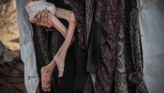 İsrail'in ablukası nedeniyle kıtlık yaşanan Gazze’de açlıktan ölenlerin sayısı 457’ye yükseldi