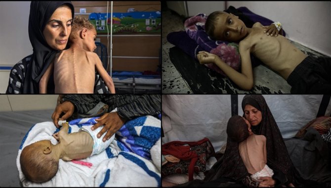 Gazze'de İsrail'in açlıktan ölüme mahkum ettiği çocukların hikayeleri soykırımın boyutunu gösteriyor