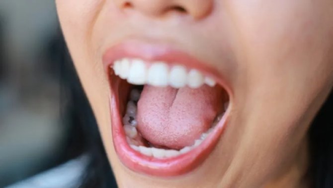 Dil rengi ve dokusu sağlık sorunlarının habercisi olabilir