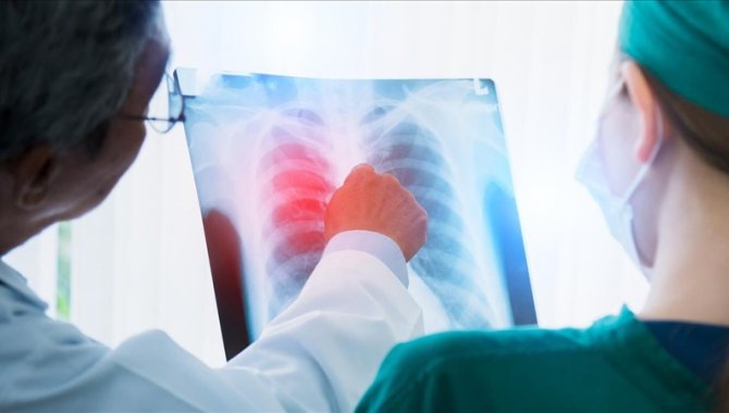 Akciğer kanserinde çevresel faktörlerin etkisi artıyor