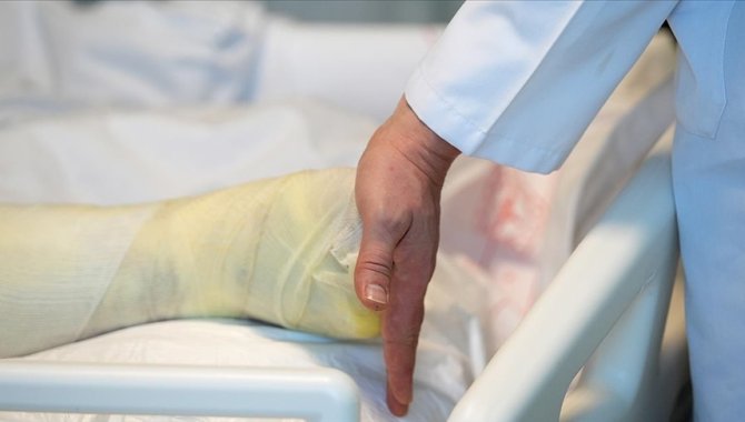 Türkiye'nin yanık tedavisindeki tecrübesi Suriye'deki hastalara da katkı sunuyor