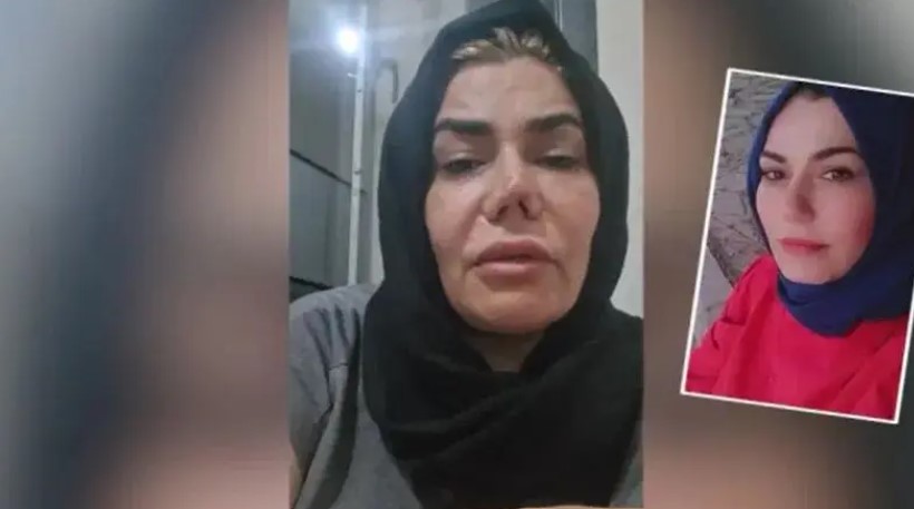 Elazığ'da 4 Yılda 4 Kez Burun Ameliyatı Oldu, Hayatı Karardı: Doktora ve Kliniğe Dava Açtı