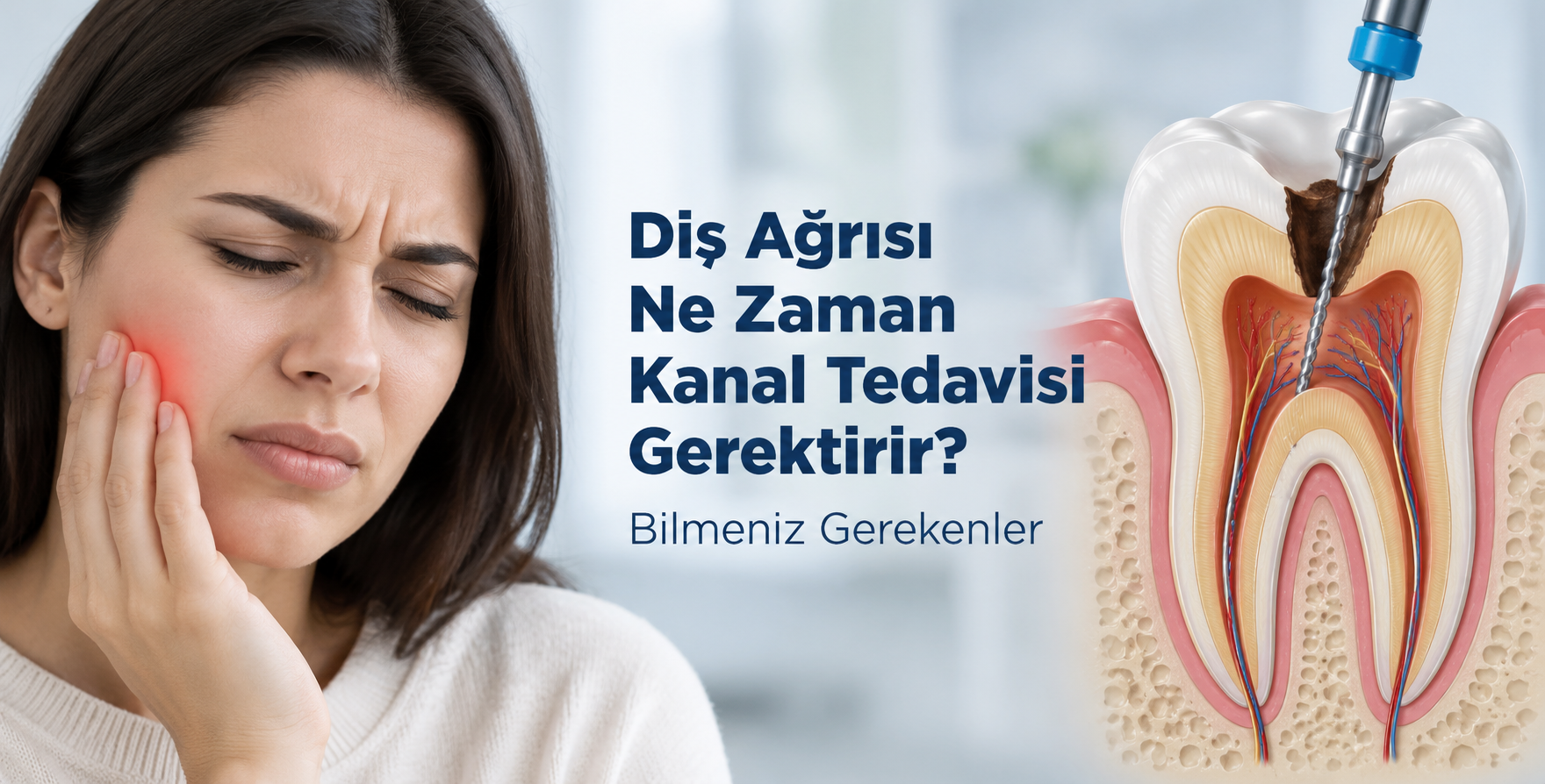 Diş Ağrısı Ne Zaman Kanal Tedavisi Gerektirir? Bilmeniz Gerekenler