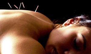 Tüp bebek tedavisinde akupunktur gebelik şansını artırıyor