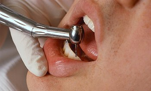 Erkekler de diş estetiğine önem veriyor