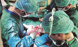 21 bin kişi organ bekliyor
