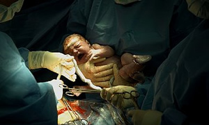 Erzurum’da 4 haftalık bebek hastaneye ölü olarak getirildi