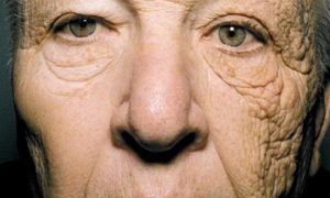 Güneş ışınları yüzünü bu hale getirdi