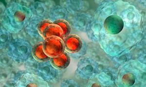 Kemoterapiye alternatif 'biyokimyasal yöntemler'