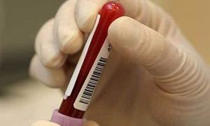 Hepatit B, AIDS'ten 100 kat daha bulaşıcı