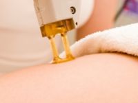 Yanlış epilasyona 1500 lira tazminat