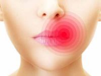 Uçuk bulaşıcı mıdır?