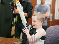3D yazıcıyla yeni koluna kavuştu