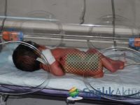 Isıtıcıda unutulan bebekte yüzde 40 oranında yanık oluştu