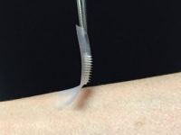 Ağrılı insülin iğnelerinin yerini, "akıllı" deri bantları alacak