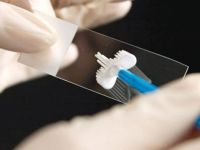 Rahim ağzı kanserinde HPV PCR testi ile erken teşhis!