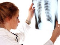 Doktor röntgen sonucunu görünce hastadan davacı oldu