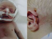 İzmir'de kulağı kopan bebekle ilgili ikinci suç duyurusu