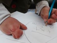 Sağlık Bakanlığı ve hayırseverler yapışık parmaklı çocuğa sahip çıktı