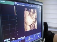 Doğumda annenin hayatını kurtaran yöntemde Türk imzası