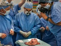 Amerika'da yüz nakli ameliyatında çarpıcı fotoğraf gündem oldu