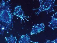 Kanser neden ortaya çıkar? Bilim insanları nedeni buldu