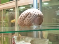 Uzun süre tanı almayan çölyak, beyin yapısını da etkiliyor