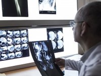 Meme kanserinde 'mamografi' hayat kurtarıyor