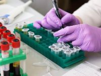 Bilim Kurulu Üyesi: Antikor testleri 81 ilde pazartesi başlayacak