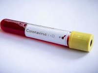 Kovid-19 tedavisinde "hidroksiklorokin" ilacı kullanılmayacak
