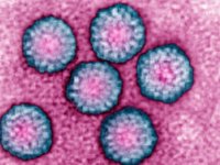 HPV Nedir? Tedavisi, Nedenleri