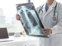 COVID-19 için çekilen tomografiler akciğer kanserlerini erken evrede yakaladı