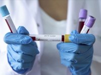 Kovid-19 vaka yoğunluğu hızla artan Karabük'te "aşı ve tedbir" çağrısı