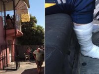Mersin'de engelli asansörünün düşmesi sonucu 2 sağlık görevlisi yaralandı
