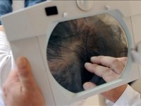 Türkiye'ye saç ekimi tedavisi için gelenlerin yüzde 70'i Avrupa'dan